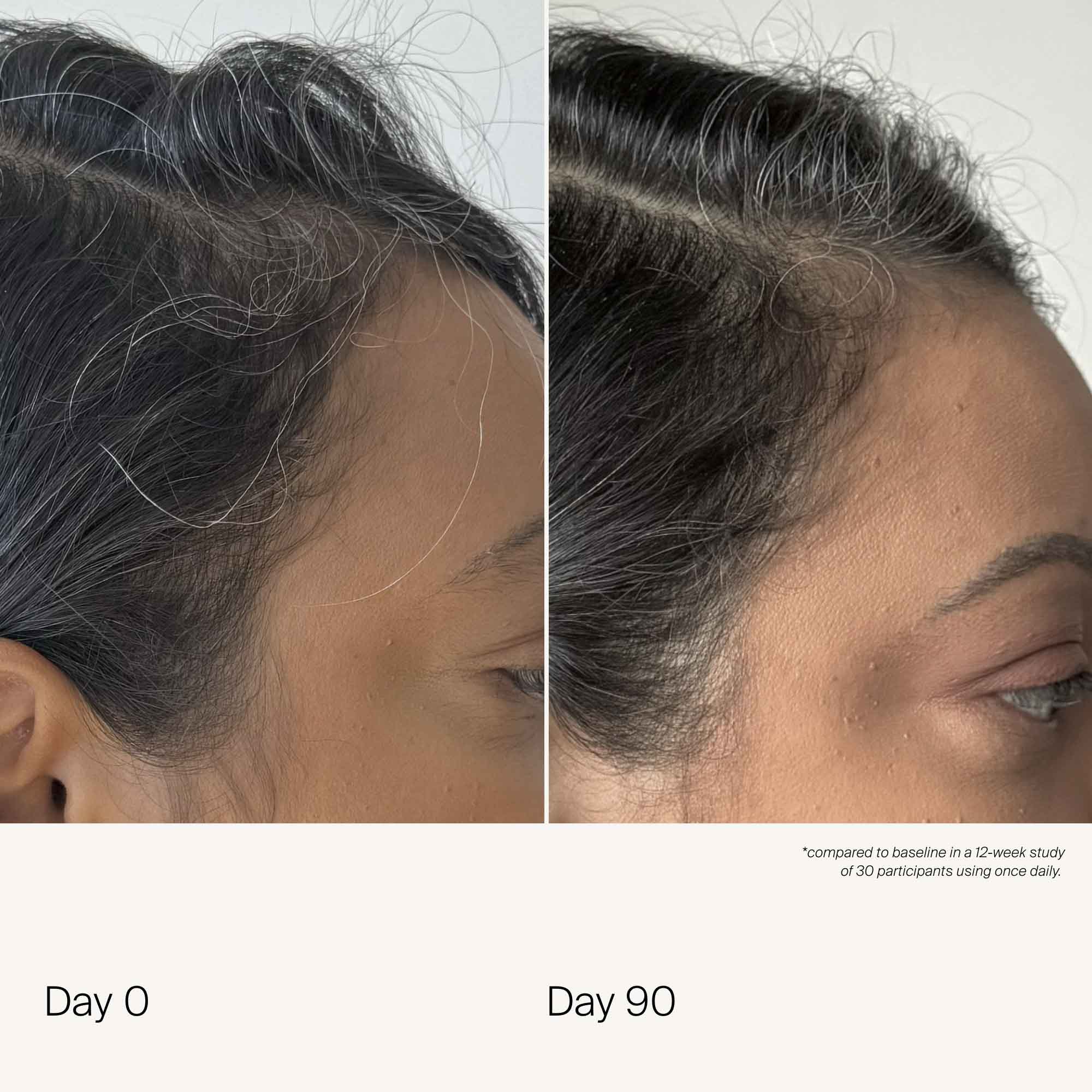 Scalp Care Density Serum - Image 4